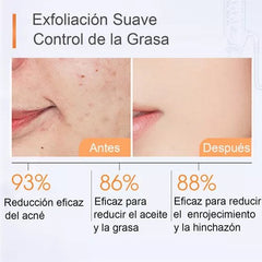 ÁCIDO SALICÍLICO EXFOLIANTE OIL CONTROL ACNE CLEANSER 75 ML