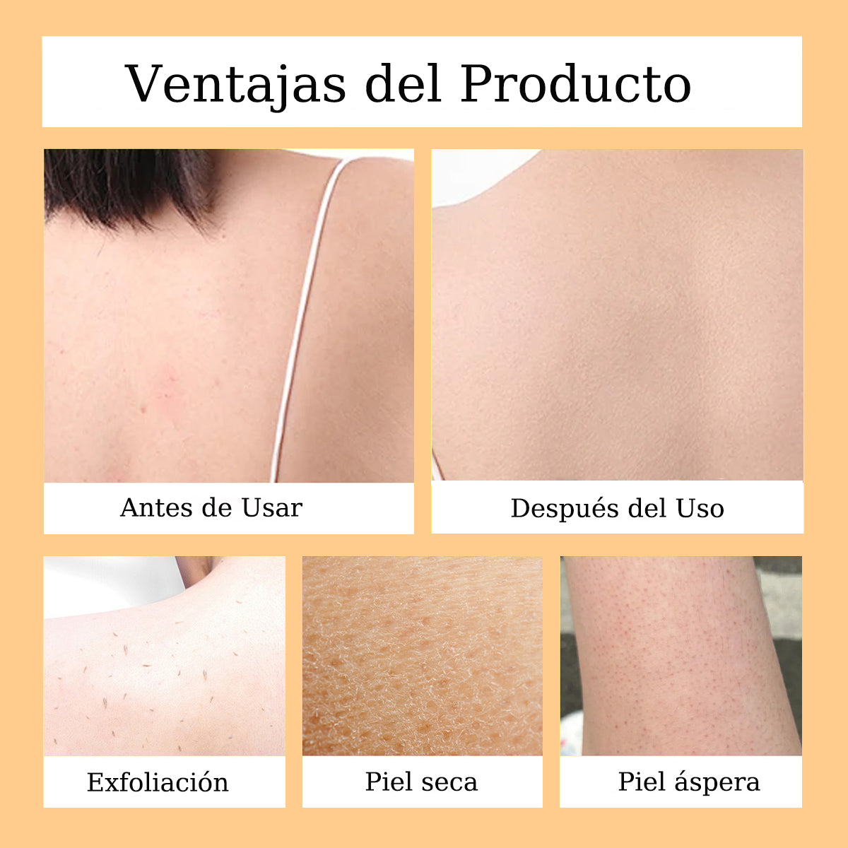 50% DE DESCUENTO EN JABÓN DE CÚRCUMA BLANQUEADOR Y ANTIPECAS